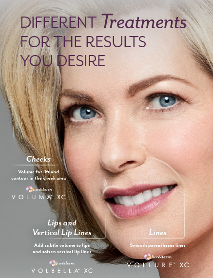 juvederm treatments